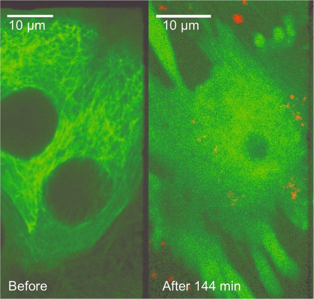 5 Colchicin-Freisetzung in lebenden Zellen durch poröse, lipid-ummantelte Glasnanopartikel. Der grüne Kanal zeigt das GFP-gelabelte Cytoskelett, der rote Kanal die Nanopartikel, (a) zeigt eine unbehandelte Krebszelle, (b) zeigt eine Krebszelle 144 Minuten nach Inkubation mit lipidummantelten, Colchicin-beladenen Nanopartikeln. (Archiv: Vogel Business Media)