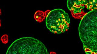 Das ist ein ganz besonderes Composit: Bakterien, etwa Hefe, in einem Trägermaterial eingebettet. Das ist „Lebendes Material“. Es kann für neue Bio-Kunststoffe, selbstheilenden Beton oder Implantate genutzt werden. (INM)