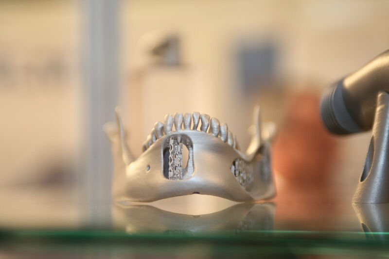 Neue Chancen in der Medizin: Prothese aus dem 3D-Drucker. (Bild: Scott Davidson)