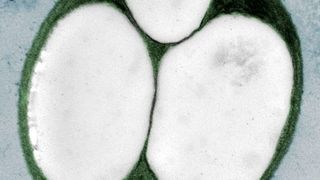 Neue Varianten des Bakteriums produzieren deutlich mehr PHB. (Moritz Koch)