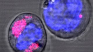 Zwei CD34+-Stammzellen, in denen sich Kohlenstoff-Nanopartikel befinden (magenta gefärbt); in Blau sind die Zellkerne zu sehen. Die Forscher stellten fest, dass die Nanopartikel in den Lysosomen der Zelle eingeschlossen sind. (HHU / Stefan Fasbender)