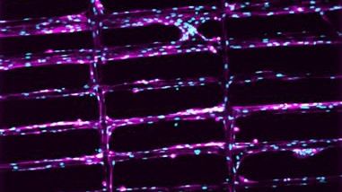Das Gitterdesign des Gerüsts, an dem die Zellen wachsen: Myoblasten, die sich an die MEW-Gerüste anlagern. Blau zeigt den Muskelzellkern (DAPI) und rosa die Filamente der Muskelzellen (F-Aktin). (Bild:  University of Oregon)