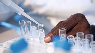 Ein interdisziplinäres Forschungsteam des Paul-Ehrlich-Instituts (PEI) hat einen neuen Labortest entwickelt, der die Bestimmung von adjuvantierten Allergoiden in Fertigarzneimitteln ermöglicht. (Bild: Andreas Buck/Paul-Ehrlich-Institut)