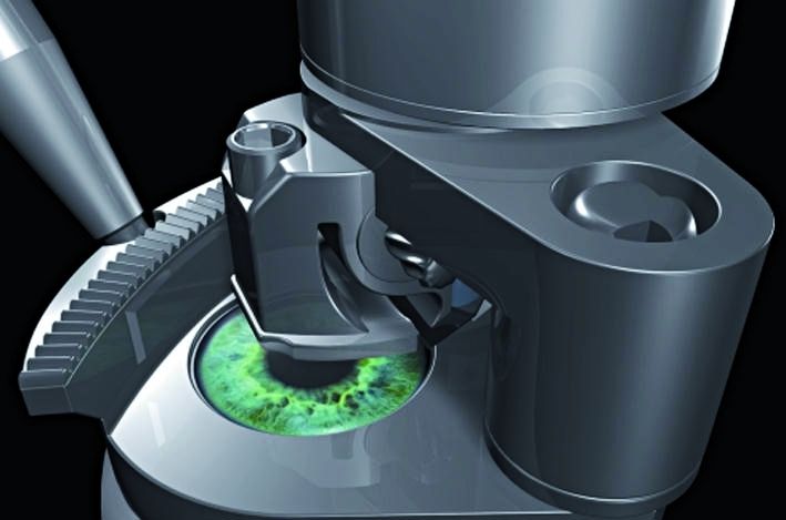 Abb.3: Hand in Hand Keratom, angetrieben von einer „two-speed“ Motor-Getriebe-Einheit. Bilder: maxon motor (Archiv: Vogel Business Media)