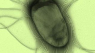 Salmonellen könnten in Zukunft zur Behandlung von Tumoren genutzt werden. (Bild: HZI/Rhode)