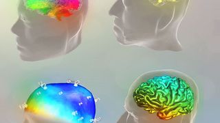 The Virtual Brain ist eine Open-source-Software zur personalisierten Simulation von Gehirnen. (Jessica Palmer/The Virtual Brain)