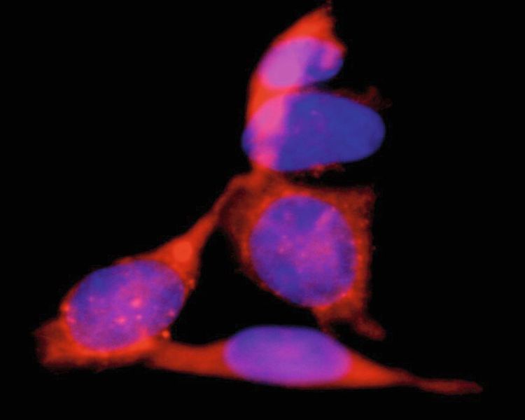 Zellen, die mit dem neu entwickelten gelabelten Conotoxin inkubiert wurden.  (© Markus Muttenthaler und Marco Inserra)