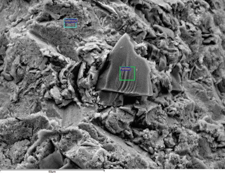 Bild 3: Elektronenmikroskopie Bild eines Partikelrückstandes auf einem Implantat und die ... (Bild: Nanoanalytics)