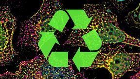 Endosomes de tri (verts) et vésicules de recyclage (magenta) dans des cellules humaines. (Image :Biozentrum, Université de Bâle)