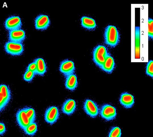Fluoreszierende Sensorbakterien, helfen den Forschenden dabei, antimikrobielle Peptide wie Bacteriocine zu detektieren. Die Fluoreszenzmikroskopischen Aufnahmen zeigen einzelne Bakterien. Bei Kontakt mit dem Bacteriocin leuchten die Sensorbakterien im Außenbereich blau-grün. Fluoreszierende Sensorbakterien, helfen den Forschenden dabei, antimikrobielle Peptide wie Bacteriocine zu detektieren. Die Fluoreszenzmikroskopischen Aufnahmen zeigen einzelne Bakterien. Bei Kontakt mit dem Bacteriocin leuchten die Sensorbakterien im Außenbereich blau-grün.