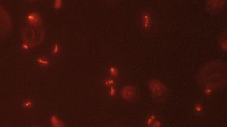 Abb. 1: Mit Nilrot gefärbte Zelle Rhodospirillum rubrum mit dem Fluoreszenzmikroskop beobachtet (Vergrößerung 100x). (Bild: S. Karmann, HES-SO Valais - Wallis)