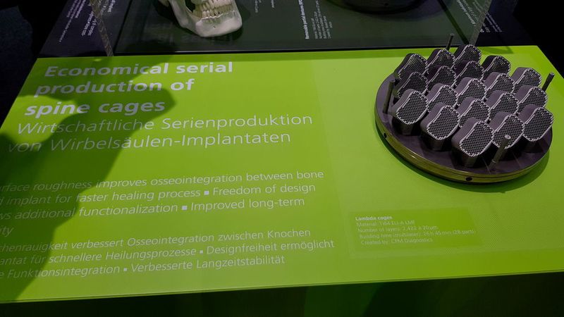... So können z.B. Wirbelsäulen-Implantate wirtschaftlich in der Serie hergestellt werden... (D.Quitter/konstruktionspraxis)