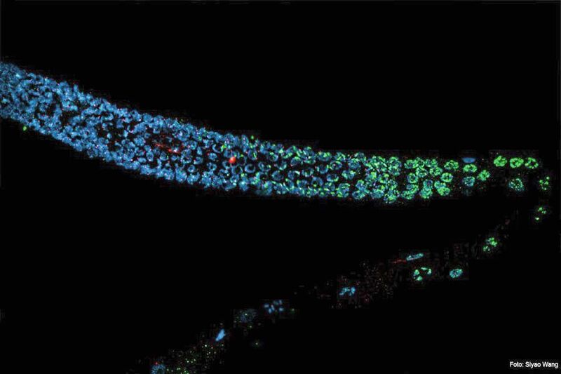 Schäden im väterlichen Genom des Fadenwurms Caenorhabditis elegans werden nicht repariert und stattdessen an die Nachkommen weitergegeben, während die weibliche Eizelle die Schäden repariert oder eingeht.