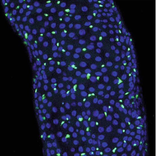 Sexualhormone steigern die Gefahr, dass onkogene Mutationen Tumoren auslösen. Das Bild zeigt Darmstammzellen mit einer krebstreibenden Mutation (grün) Sexualhormone steigern die Gefahr, dass onkogene Mutationen Tumoren auslösen. Das Bild zeigt Darmstammzellen mit einer krebstreibenden Mutation (grün)