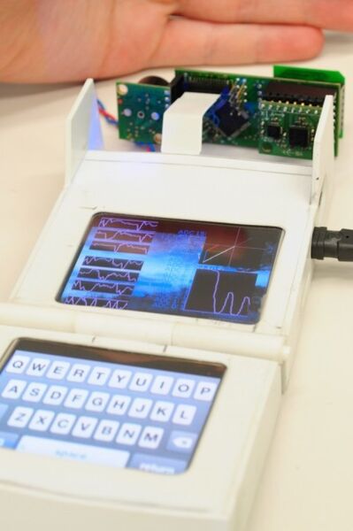 Die von den Sensoren des Mark 2 erfasste Wärmeverteilung auf der oben im Bild zu sehenden Hand wird grafisch auf dem OLED-Display dargestellt (Bild: tricorderproject.org)