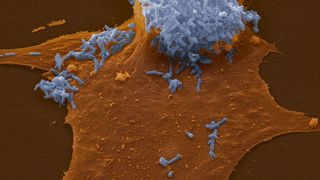 Der Erreger Bartonella henselae (Universität Basel, Biozentrum)