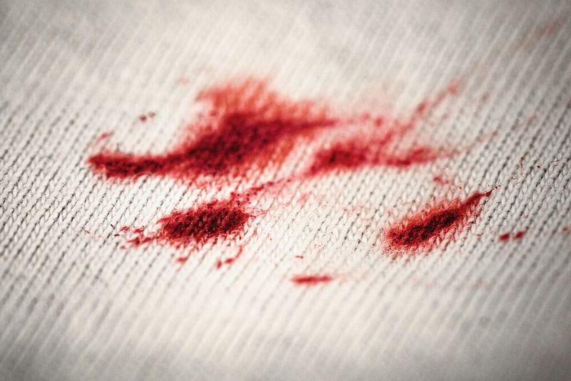 Winzige Spuren können Ermittlerinnen und Ermittlern große Erkenntnisse über einen Tathergang liefern – wenn man sie richtig auswerten kann. (Bild: Damian Gorczany)