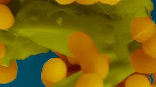 mage from an electron microscope showing how Enterococcus faecalis bacteria clump together to share, among other things, antibiotic resistance with each other. (Source: Josy ter Beek)