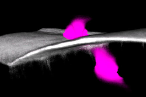 An immune cell (magenta) breaches the basement membrane to access cancer cells. The basement membrane separates different tissues in the body and plays an important role as a barrier in confining tumours. (University of Bristol)
