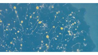 Mikroskopische Aufnahme der Fruchtkörper von D. discoideum auf einer Agarplatte. An der Spitze des multizellulären Organismus, wo sich auch die ruhenden Sporen befinden, ist das gelbe Pigment sichtbar. (Bild: Rosa Herbst/Leibniz-HKI)