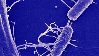 Elektronenmikroskopische Aufnahme von Salmonellen.  (Bild: Manfred Rohde/HZI)