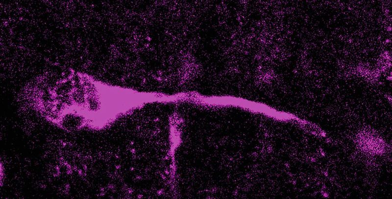 Mikroskopische Aufnahme einer sich teilenden basalen radialen Gliazelle, einer Vorläuferzelle, aus der während der Gehirnentwicklung Neuronen entstehen. Modernes menschliches TKTL1, aber nicht das des Neandertalers, erhöht die Anzahl der basalen radialen Gliazellen und Neuronen. 