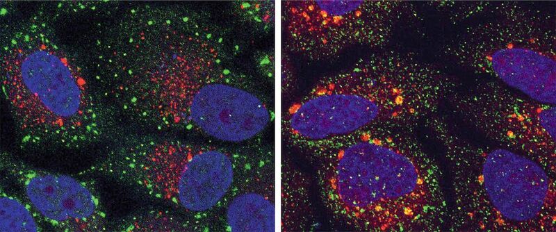 Farbige Mikroskopie-Aufnahmen, die Zellen mit normalen (grüne Punkte) und abnormalen (gelbe Punkte) Stressgranula zeigen. (AG Buchberger)