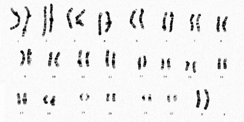 Ein vollständiger Chromosomensatz aus einer Körperzelle einer Frau. (Bild: Serpil Borlu / iStock)