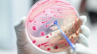 Potenziell krankmachende Bakterien werden zunehmend resistent gegen Antibiotika. Ein globales Problem, das jedes Jahr etwa 5 Millionen Menschenleben fordert. (Symbolbild) (Bild: analysis121980 - stock.adobe.com)