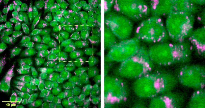 Researchers developed a Raman microscope that can acquire information hundreds of times faster than a conventional Raman microscope. This extra speed makes it possible to acquire large-area hyperspectral images of living cells, such as the ones seen here.