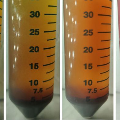 Nährbouillon, mit der die Abtrennung roter Blutkörperchen aus Vollblut untersucht wurde. Dem Blut war eine koloniebildende Einheit von Escherichia coli zugesetzt worden. Die Proben wurden vier Stunden lang bei unterschiedlichen orbitalen Schüttelgeschwindigkeiten inkubiert – von links nach rechts: 0, 65, 120 und 200 U/min. Dabei bildet sich im oberen Bereich der Gefäße eine bakterienreiche, plasmaähnliche Schicht, während die zu sogenannten Rouleaux verklumpten roten Blutkörperchen zu Boden sinken (Bild: Pak Kin Wong)