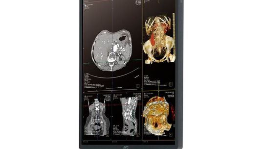 Der CL-S301(Bild:  JVC Kenwood)
