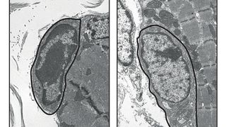 Aus der Form: Während das so genannte Heterochromatin im Zellkern einer normalen Satellitenzelle (markierte Zelle links) im Elektronenmikroskop eine charakteristische dunkle Färbung aufweist, ist der DNA-Faden bei einer Satellitenzelle ohne Pax7 (rechts) wesentlich weniger stark kondensiert. Dadurch erscheint der Zellkern heller. (MPI für Herz- und Lungenforschung)