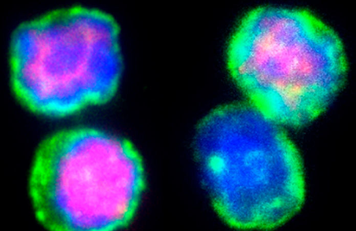 T cells after a short-term cold treatment (left) and under control conditions (right). Immunofluorescent staining of the T cell marker CD3 (green), the Treg marker Foxp3 (red) and the nucleus (blue). (Helmholtz Zentrum München)