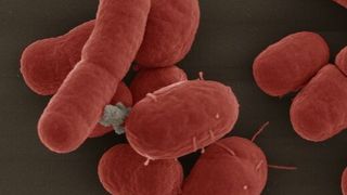 Das Bakterium Acinetobacter baumannii; Rasterelektronenmikroskopie (Bild: Gudrun Holland; Kolorierung: Michael Laue/RKI)
