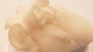 Additiv gefertigte Modelle wie dieses 3D-Herz können dazu beitragen, mögliche Komplikationen während einer OP vorherzusehen und damit zu vermeiden.  (Business Wire)
