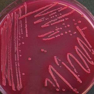 Mikrobiologische Testplatte mit Agar-Närboden. Die Platte ist bewachsen mit Escherichia coli. Mikroorganismen dieser Art sind weit verbreitete Krankheitserreger. 