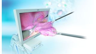 Hightech-Medizintechnologien werden nach Ansicht des Bundesverbandes Medizintechnologie, BV-Med, im aktuellen Entwurf des Krankenhaus-Zukunftsgesetzes (KHZG) zu wenig berücksichtigt.  (BV-Med)