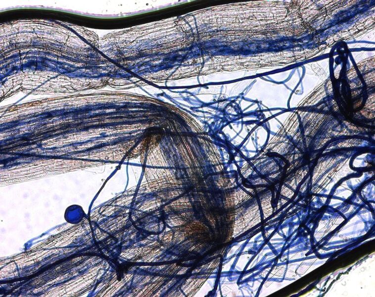 Struktur der Befalls durch den Arbuscular Mycorrhizal Fungi. (Bild: UZH)