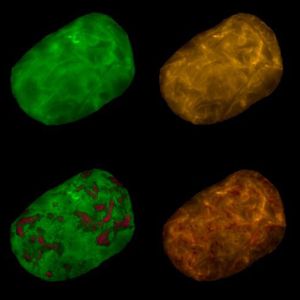 Fluorescence in-situ hybridization image of a stained Achromatium oxaliferum cell.