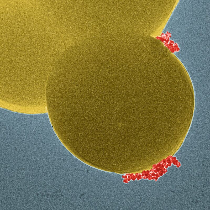 Die Magnet-Nanopartikel (rot) binden spezifisch an die rund 1 µm großen Bakterien (gelb) (Elektronenmikroskopie digital koloriert).