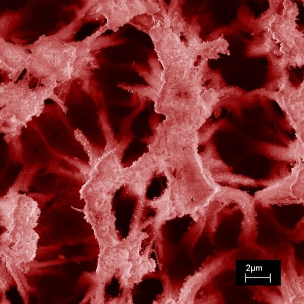 Nanoporous Silicon photographed with an scanning electron micrograph. (Picture: [M], IMtech)