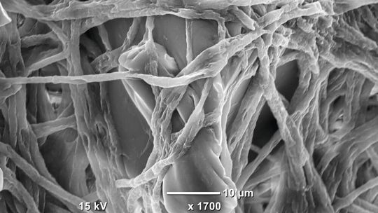 Elektronenmikroskopische Aufnahme von Fusarium auf einem Kunststoffpartikel. Fusarium ist ein Pilz, der Kunststoffpolymere abbauen kann.(Bild:  Sabreen Samuel Ibrahim Dawoud, IGB)