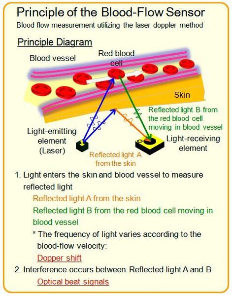 Das Prinzip der Blutflusssensoren. (Kyocera)