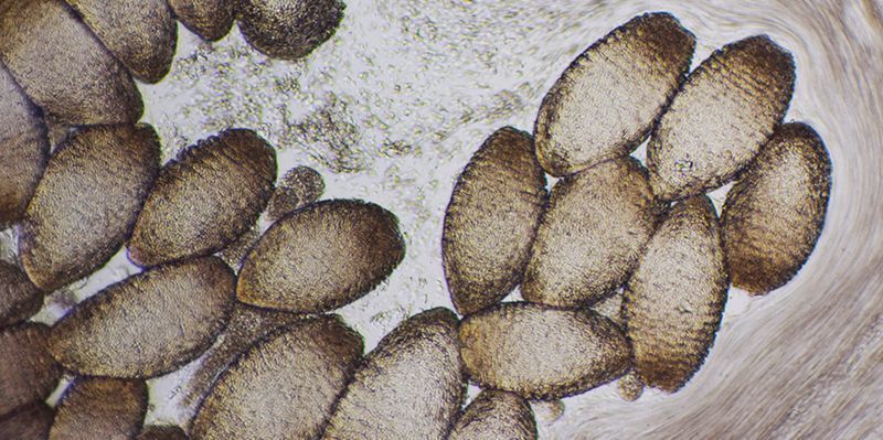Das Sekret des Schleimaals unter dem Mikroskop: In den kokonartigen Zellen ist der Proteinfaden auf spezielle Weise aufgewickelt. (Bild: ETH Zürich/Simon Kuster)