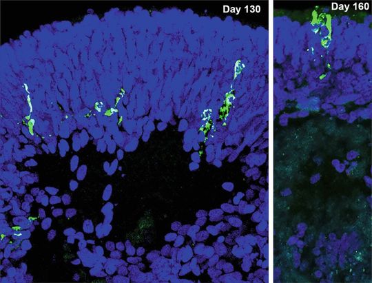 SARS-CoV-2-infizierte Zellen (grün; Immunfluoreszenz) in retinalen Organoiden. Die SARS-CoV-2 infizierten Zellen in der rechten Abbildung weisen die typische Morphologie von Photorezeptoren auf.(Bild:  MPI für molekulare Biomedizin / Yotam Menuchin-Lasowski)