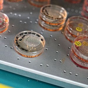 Hirnorganoide verschiedener Entwicklungsstadien im Kulturmedium in einem Brutschrank(Bild:  Karin Tilch)