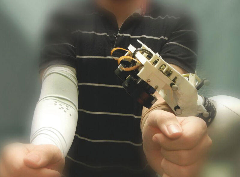 Das von Framos entwickelte optische Tracking-System (OTS) in Anwendung bei der Reha eines gelähmten Armes. (Framos)