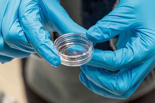 Noch sind die strukturierten Hydrogels von bloßem Auge kaum sichtbar. Ziel ist, sie in der richtigen Größe für ein Knochen-Implantat herzustellen.(Bild:  Peter Rüegg / ETH Zürich)