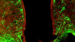 HDAC5 (rot) spielt in Nervenzellen eine wichtige Rolle für die Kontrolle der Nahrungsaufnahme, umliegende Astrozyten sind in grün eingefärbt.  (Helmholtz Zentrum München)